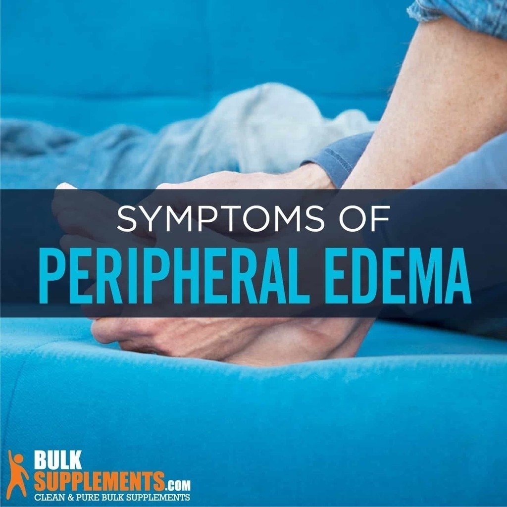Tablo Read 'Peripheral Edema Symptoms, Causes & Treatment' by