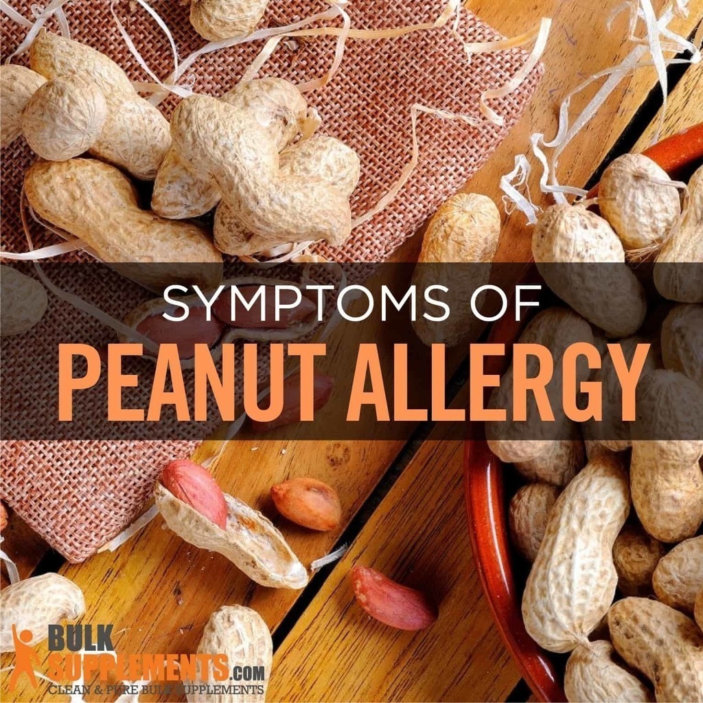 Tablo Read Peanut Allergy Symptoms Causes Treatment By