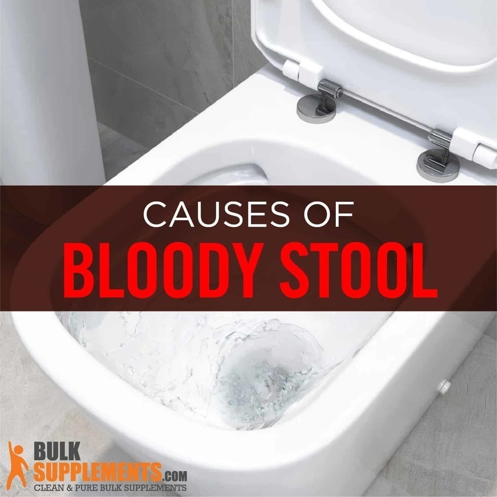 Tablo Read 'Rectal Bleeding (Bloody Stool) Causes, Characteristics